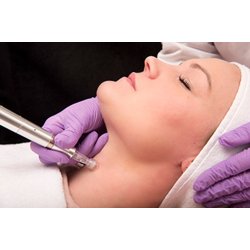 MESO NECK &amp; DCOLLETE LIFT (10 x 5 ml)